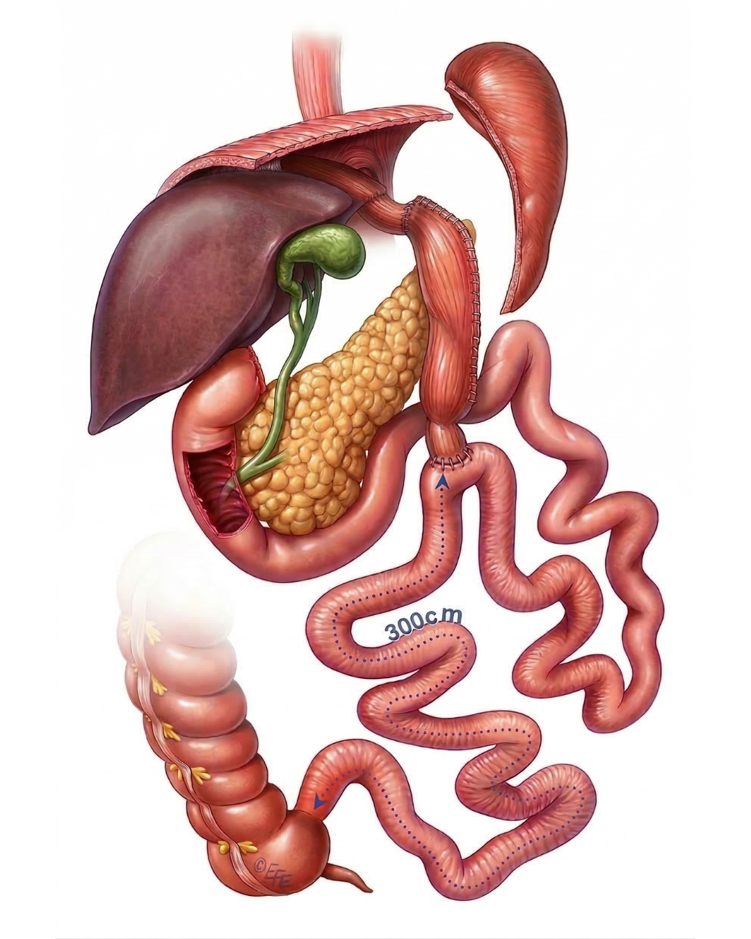 Esquema Técnico SADI-S